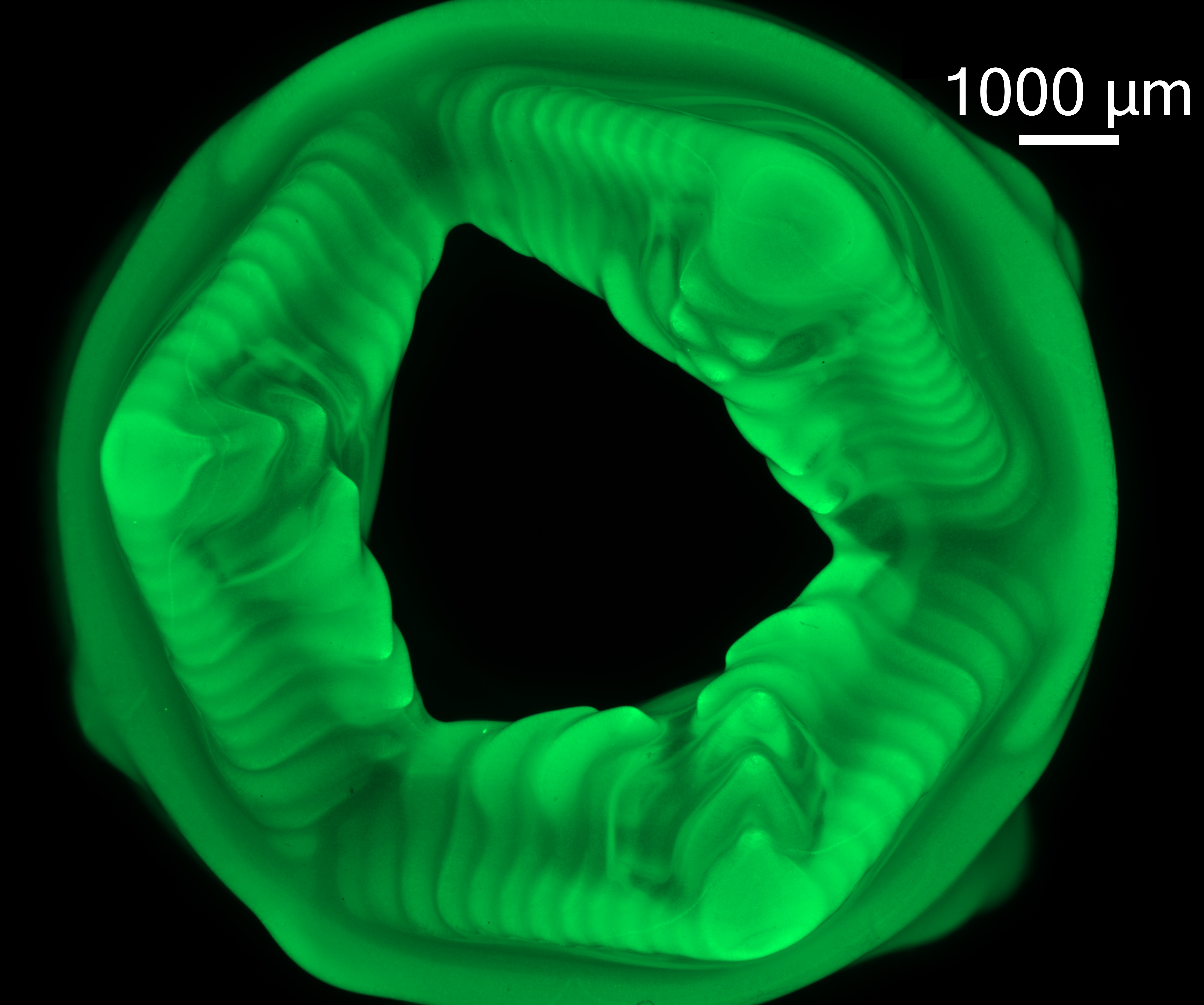 Open heart valve model printed with Elva bioink